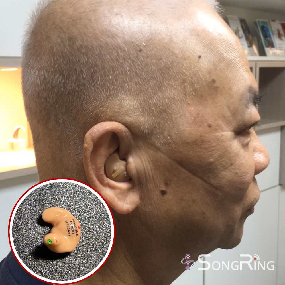頌聆客製化 耳內型助聽器